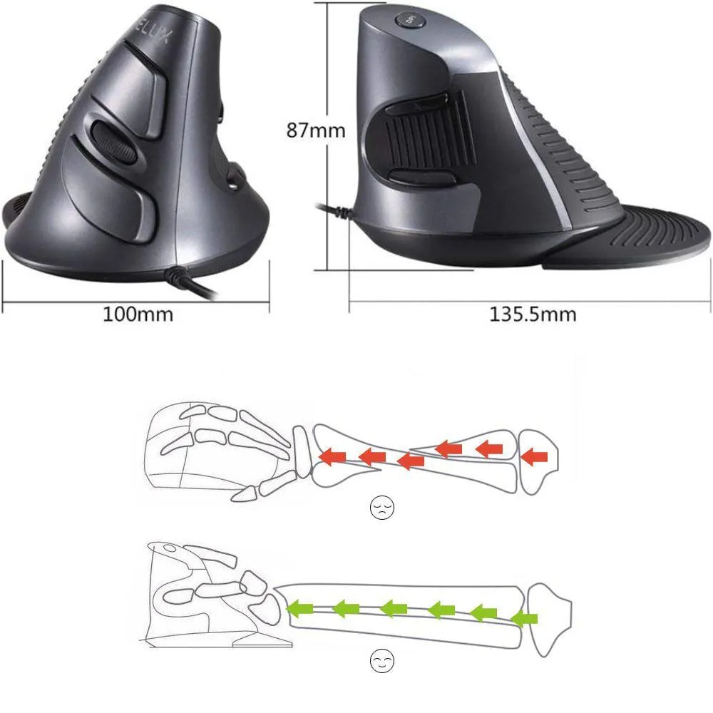 Delux M618BU Vertical Ergonomic Mouse: Wired mouse with palm rest and 6 buttons